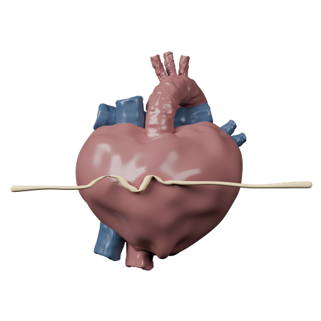 Cardiac Arrest  3D Icon