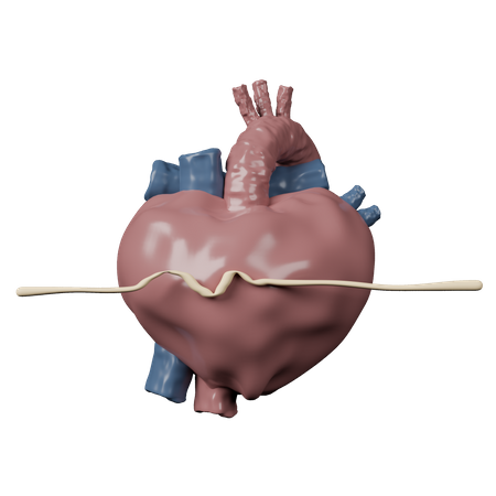 Cardiac Arrest  3D Icon