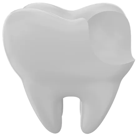 Caries dental  3D Illustration