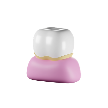 Caries dental  3D Icon