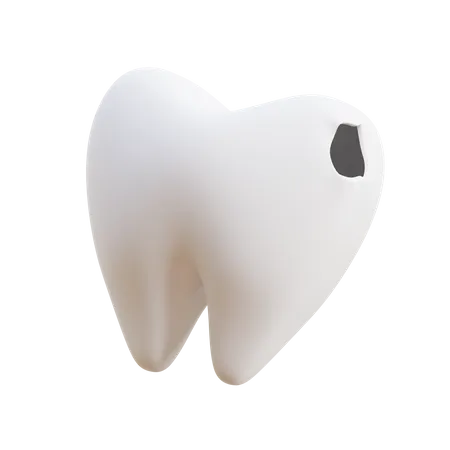 Caries Tooth  3D Illustration
