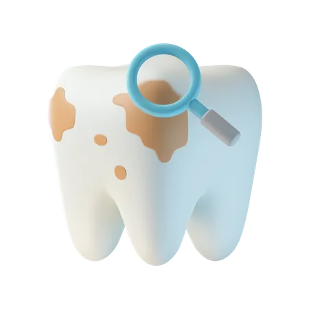 Caries Tooth  3D Icon