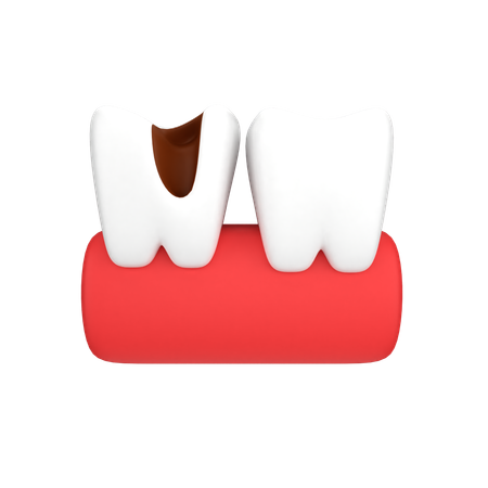 Cavité dentaire  3D Icon