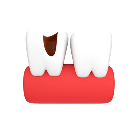 Cavité dentaire  3D Icon