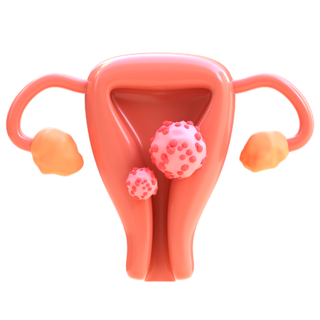 Cervical Cancer  3D Icon