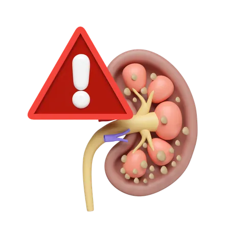 Chronic Kidney Disease  3D Icon