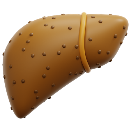 Cirrhosis  3D Icon