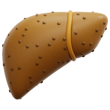 Cirrhosis  3D Icon