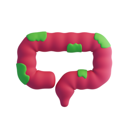 Colon cancer  3D Icon