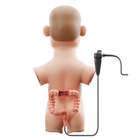 Colonoscopy bowel examination  3D Icon