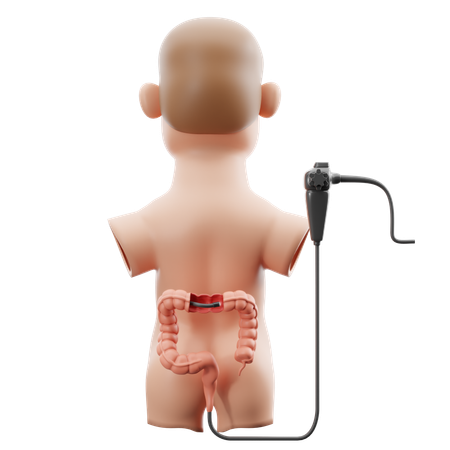 Colonoscopy bowel examination  3D Icon