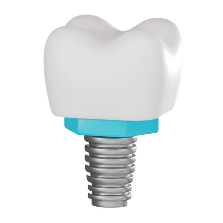 Coroa dentária  3D Icon