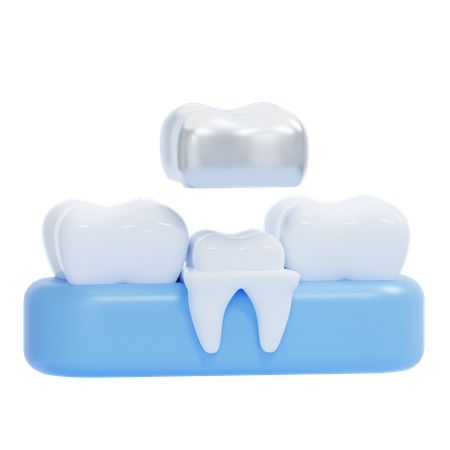 Coroa dentária  3D Icon