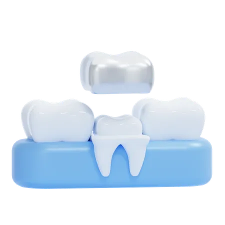 Coroa dentária  3D Icon