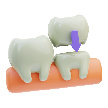 Coroa dentária  3D Icon