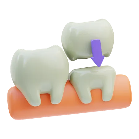 Coroa dentária  3D Icon