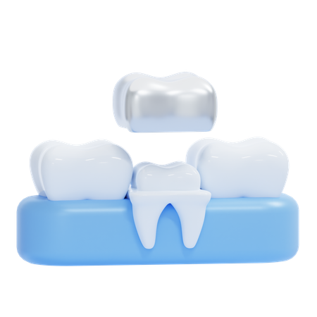 Corona dental  3D Icon