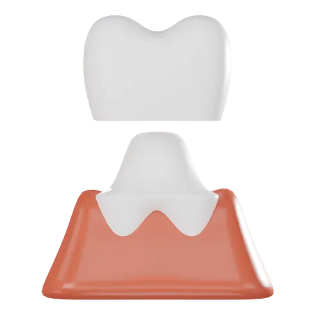 Corona dental  3D Icon