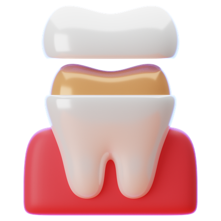 Corona dental  3D Icon