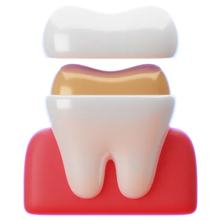 Corona dental  3D Icon