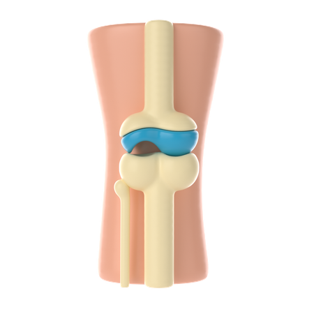 Daño articular hueso  3D Icon