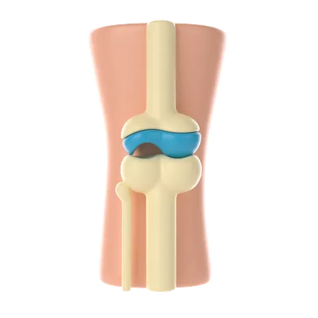 Daño articular hueso  3D Icon