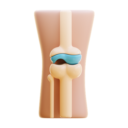 Daño articular  3D Icon