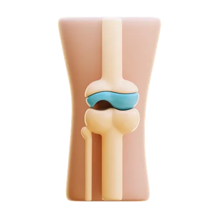 Daño articular  3D Icon