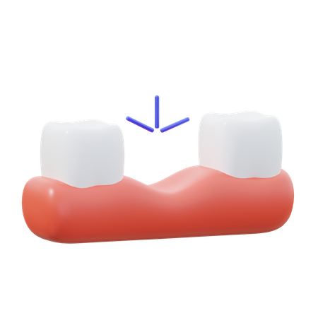 Dent manquante  3D Icon