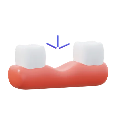 Dent manquante  3D Icon