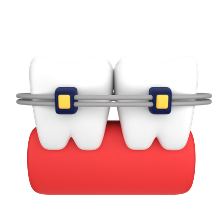 Dental Braces  3D Icon