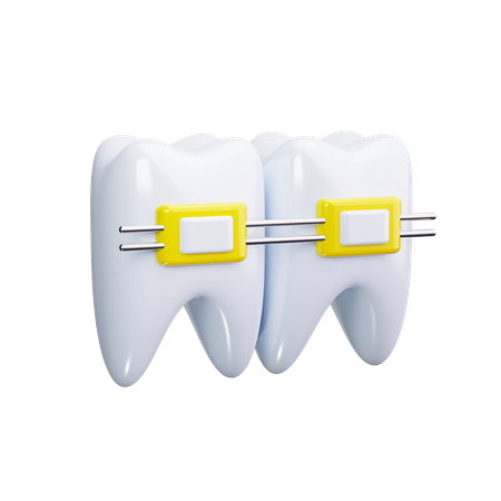 Dental Braces 3D Icon