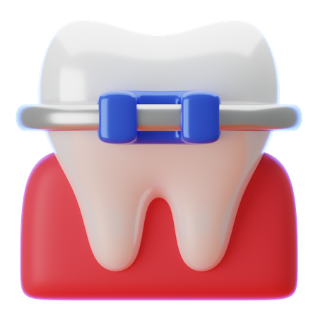 歯列矯正具  3D Icon