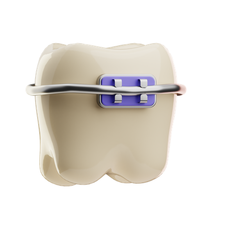 Dental Braces  3D Icon