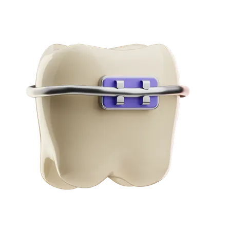 Dental Braces  3D Icon