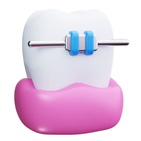 Dental Braces  3D Icon