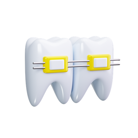 Dental Braces  3D Icon