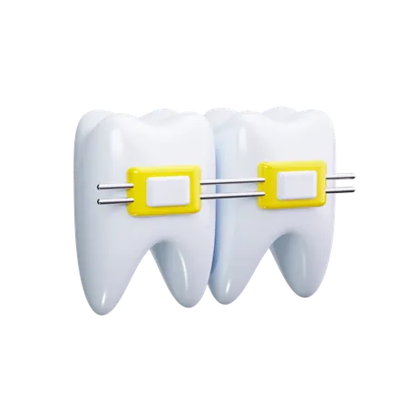 Dental Braces  3D Icon