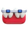 Dental Braces