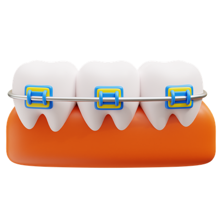 Dental Braces  3D Icon