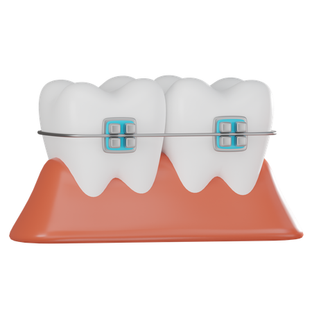 Dental Braces  3D Icon