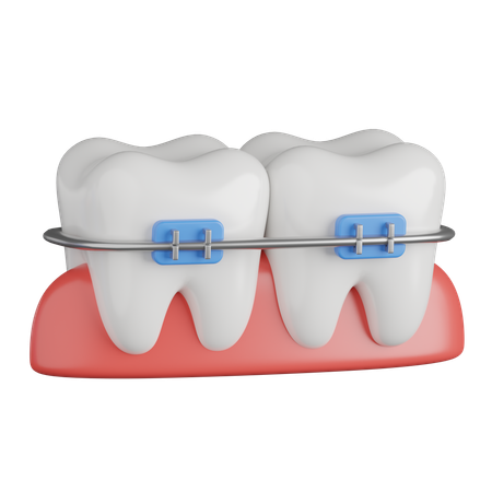 Dental Braces  3D Icon