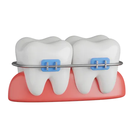 Dental Braces  3D Icon
