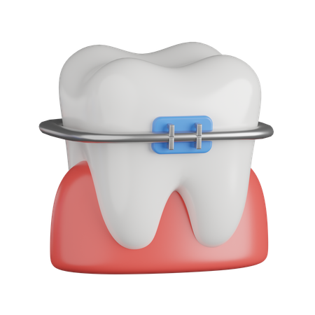 Dental Braces  3D Icon