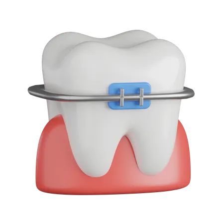 Dental Braces  3D Icon