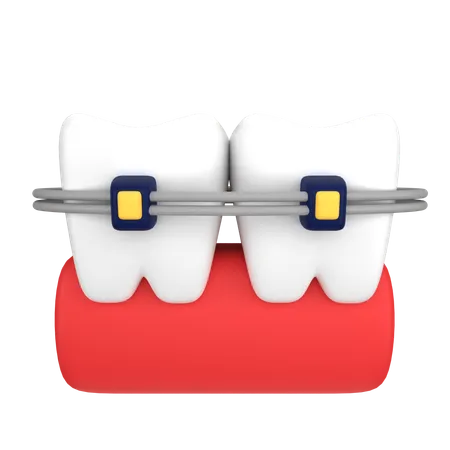 Dental Braces  3D Icon