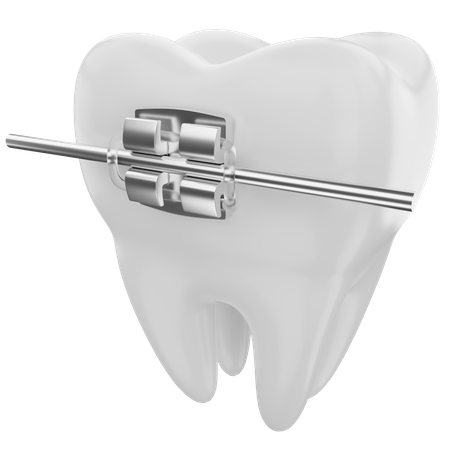 Dental braces  3D Illustration