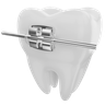 dental braces graphics