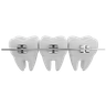 3d dental braces illustration