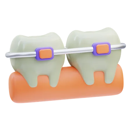 Dental Braces  3D Icon